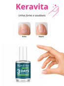 Keravita™ — Esmalte Restaurador Profissional para Unhas