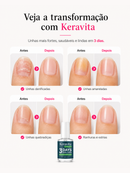 Keravita™ — Esmalte Restaurador Profissional para Unhas